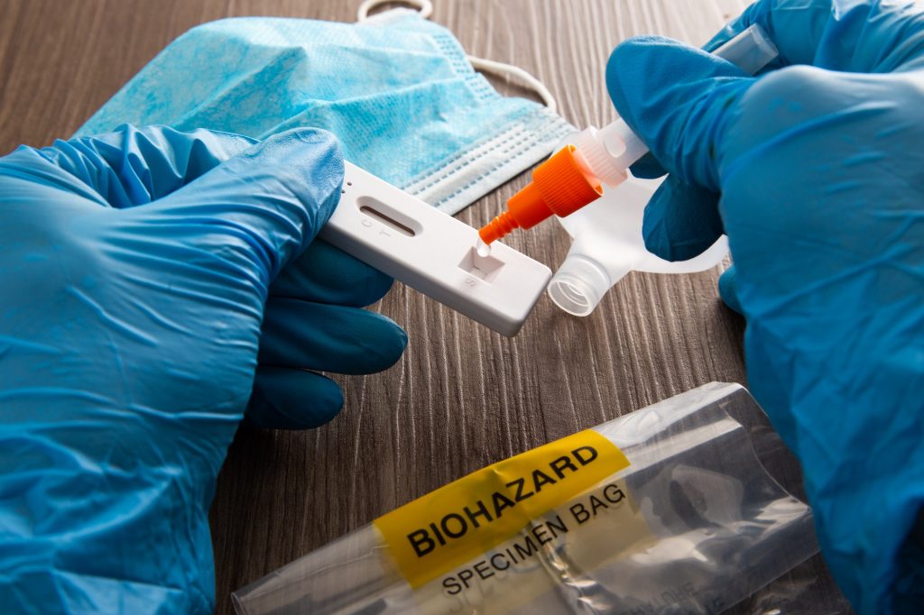 Hand with blue surgical glove placing the sample into the covid-19 antigen diagnostic test device